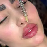 کلنیک زیبایی مهرو