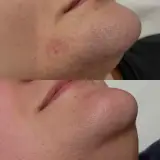 کلینیک زیبایی و لیزر آلورا بیوتی