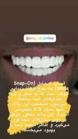خدمات دندانسازی و اسنپ اسمایل بهشتی