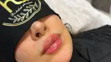 کلینیک تخصصی پوست مو و لیزر آوا