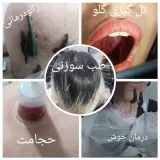تل گیر