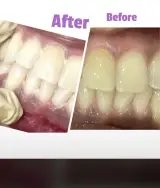 مطب دندانپزشکی دکتر هاله کرمیان در کرج