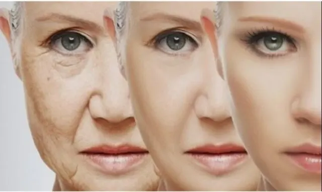 مطب زیبایی و لیزر شفا