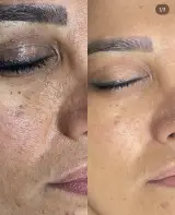خدمات ماساژ و پاکسازی پوست زهره بداقی