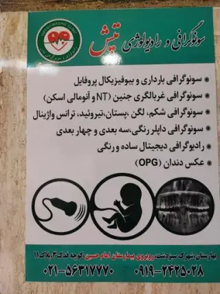 سونوگرافی تپش