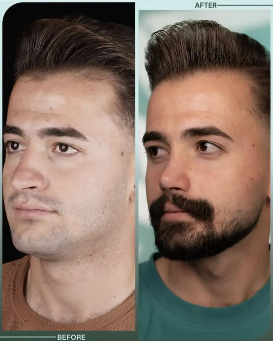 دکتر فرهاد محرابی سی سخت