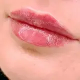 دکتر عارف اکبری /پوست مو زیبایی/بوتاکس/فیلر