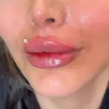 کلینیک زیبایی اپال در کرمانشاه