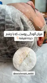 فیشال تخصصی سعیده صدیقی