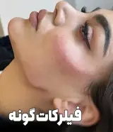 کلینیک زیبایی، پوست و مو نچرال بیوتی