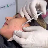 مرکز زیبایی رخ | ژل| فیلر | بوتاکس | حذف غبغب | پی آر پی