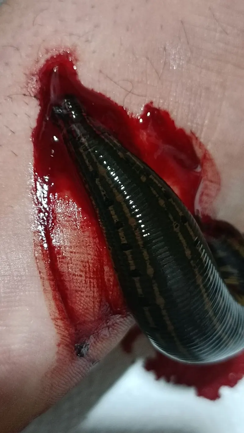 طب سنتی لایف