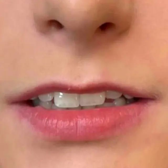 کلینیک زیبایی آیسونا