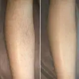 کلینیک لیزر نور