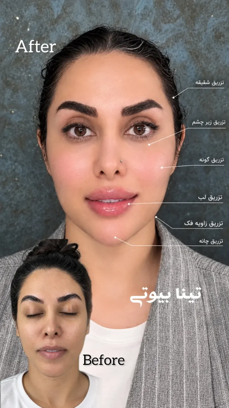 Tina Beauty Center