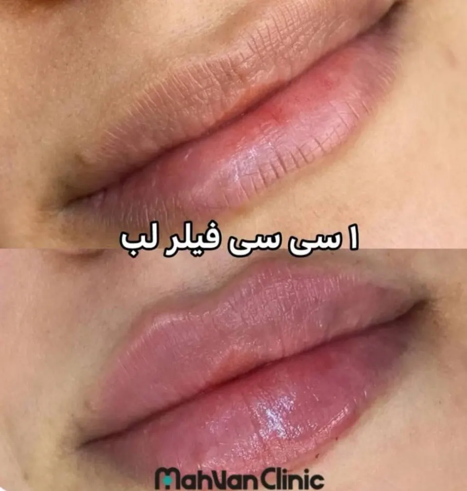 کلینیک زیبایی مهوان