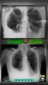 پارس پرتو آزادیانی