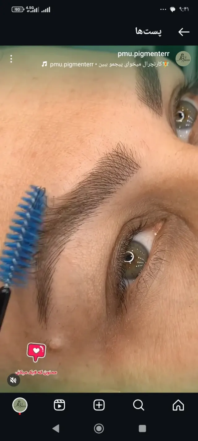 میکرونچرال ابرو سمیرا
