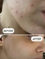 خدمات تخصصی پوست سمیه اکرمی