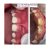 دندانپزشکی دکتر زارعیان متخصص اطفال