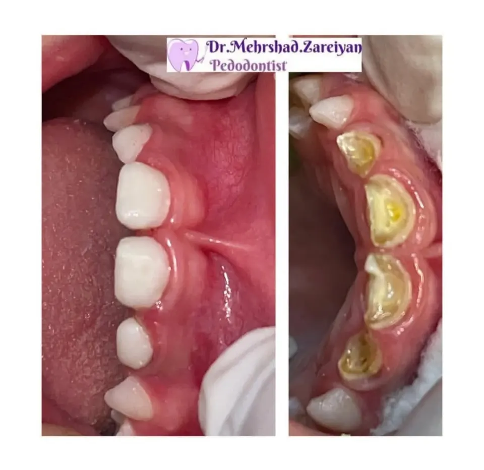 دندانپزشکی دکتر زارعیان متخصص اطفال