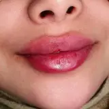 مطب زیبایی دکتر مصطفی کریمی
