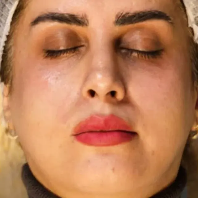 کلینیک زیبایی دکتر حمید مرادزاده اسمعیلی