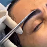 کاشت ابرو شادی حسینی
