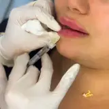 مطب زیبایی آلبارز در قلیپور رشت