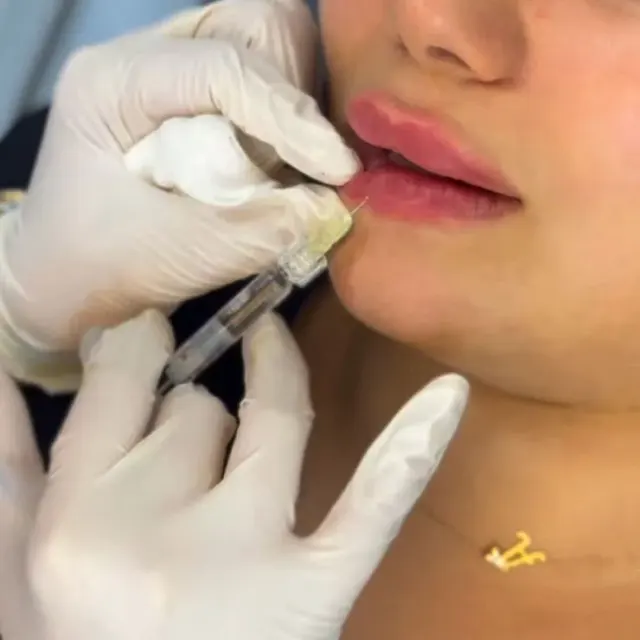 مطب زیبایی آلبارز در قلیپور رشت