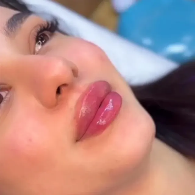 کلینیک زیبایی گلد اسکین