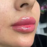 مرکز پاکسازی و زیبایی پوست کامبیز خالقی