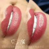 زیبایی شقایق