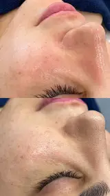خدمات پوست و مو (فیشیال)