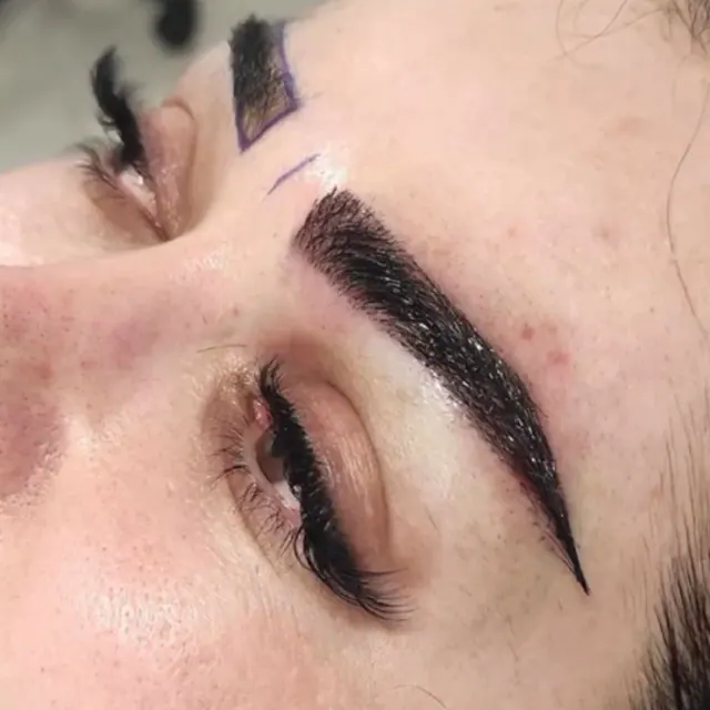 کارشناس کاشت مو زهرا اکبری