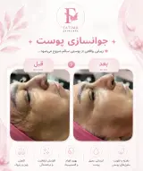 خدمات تخصصی فیشیال و ماساژ فاطمه