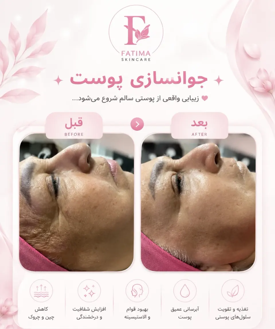 خدمات تخصصی فیشیال و ماساژ فاطمه