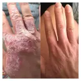 طب سنتی مزاج شناسی و درمان بیماریها