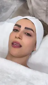 فیشال و پاکسازی تخصصی پوست سولماز