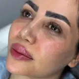 مرکز زیبایی و تزریق ژل و بوتاکس صبا میر در خرم آباد