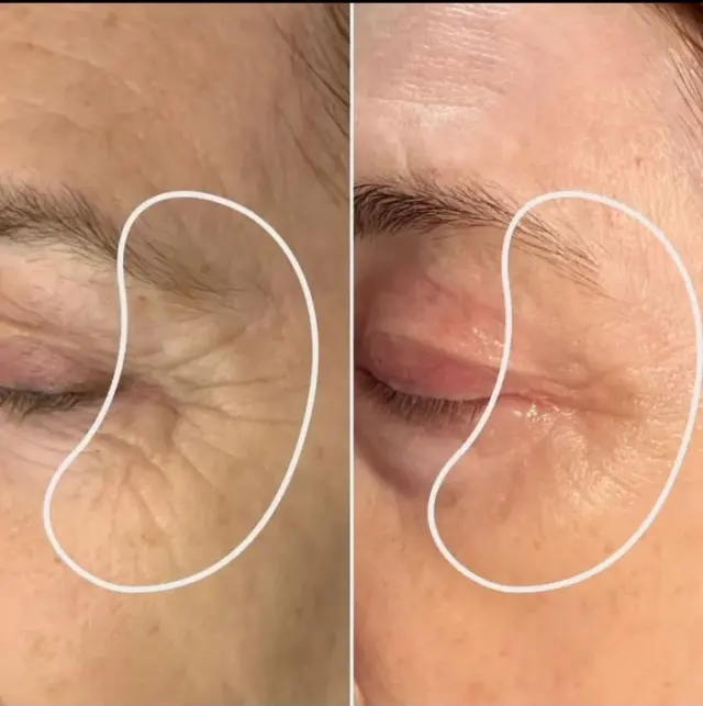 خدمات فیشیال و پاکسازی بانو طالبی