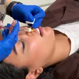 مطب زیبایی و لیزر بنیز