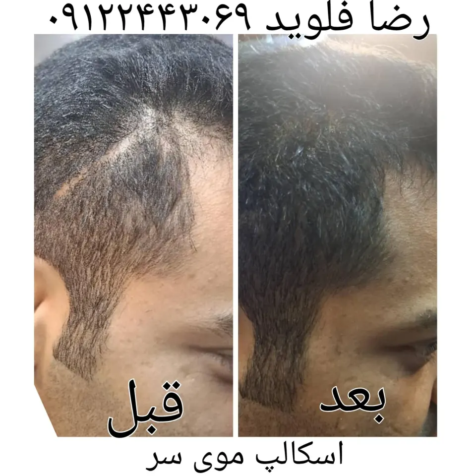 آرایش پارت