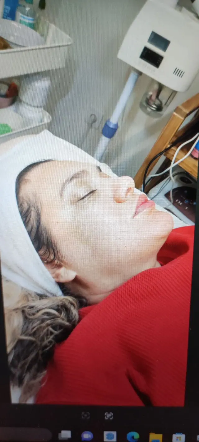 خدمات پاکسازی پوست غزال