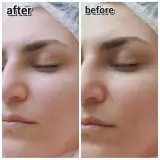 فیشال تخصصی پوست