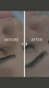 پاکسازی و آبرسانی صورت(فیشال)