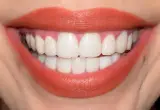 مطب زیبایی دکتر اسما ارجمندی در تهرانپارس غربی