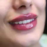 دکتر مریم ایزدیان | پزشک زیبایی
