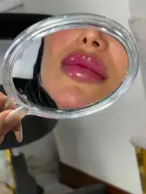 کلینیک تخصصی زیبایی فیلر بادی و زاویه سازی صورت بنیتا در شرق تهران