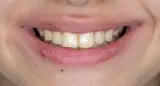 فتوگرافی پزشکی تکرنگ طب